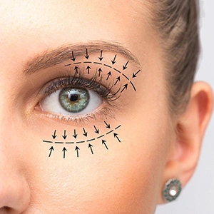 Chirurgie des yeux en amande